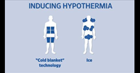 hypothermia_wsj