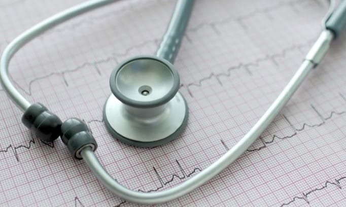 Stethoscope laying on an image of an electrocardiogram (ECG/EKG) heart rhythm reading.
