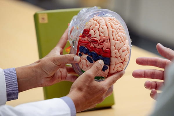 Doctors discussing a brain model