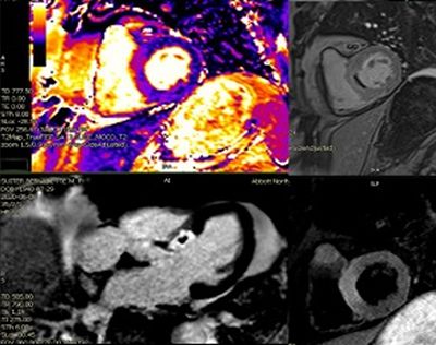 Advanced Cardiovascular Imaging Fellowship Picture3 imaging of heart