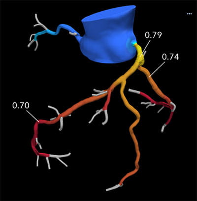 AdvancedCardiovascularImagingFellowship4B