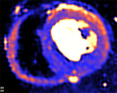 AdvancedCardiovascularImagingFellowship5A