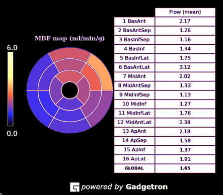 AdvancedCardiovascularImagingFellowship5B