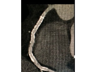 AdvancedCardiovascularImagingFellowship5C