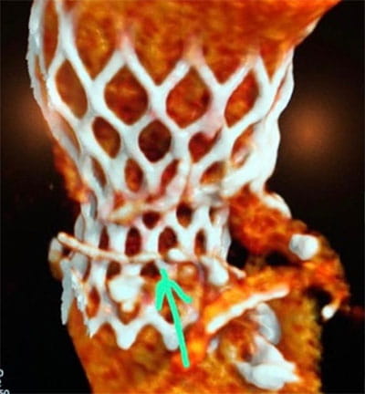 AdvancedCardiovascularImagingFellowship6A
