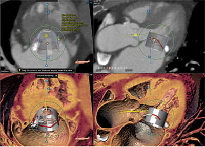 AdvancedCardiovascularImagingFellowship6B