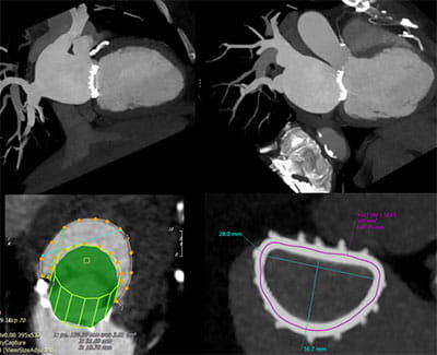 AdvancedCardiovascularImagingFellowship7
