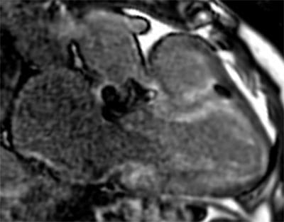 AdvancedCardiovascularImagingFellowship8A