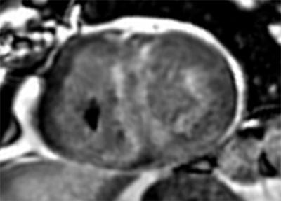 AdvancedCardiovascularImagingFellowship8B