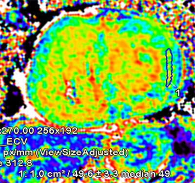 AdvancedCardiovascularImagingFellowship8C