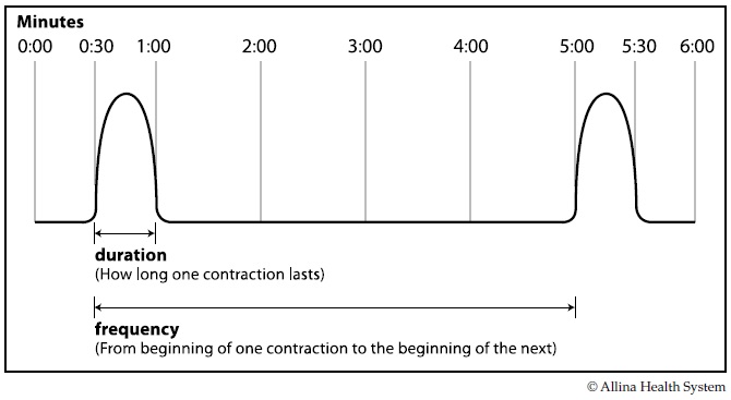 Labour Contractions Timing Chart