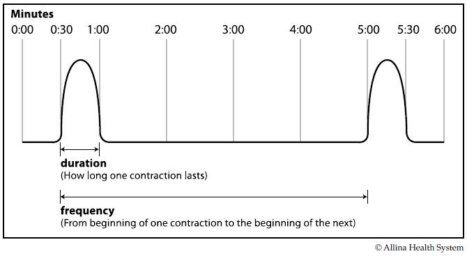 Timing contractions chart