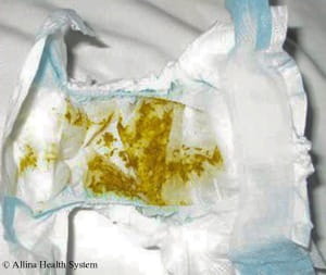 Getting Enough Milk | Pregnancy, Birth & Beyond | Allina Health Getting Enough Milk | Pregnancy, Birth & Beyond | Allina Health