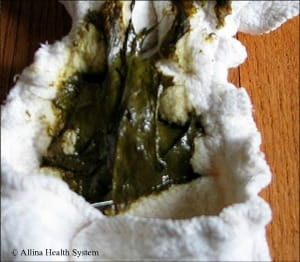 diaper transition stage 1