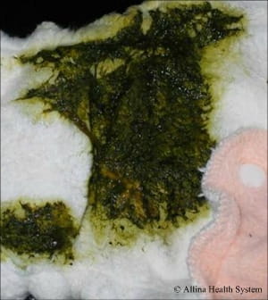 diaper transition stage 2