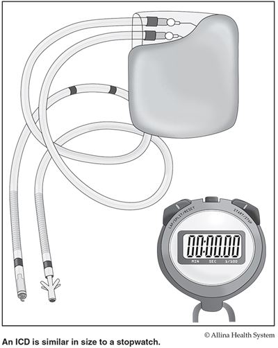 Pacemakers and ICD | Helping Your Heart | Allina Health