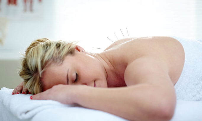 Six things acupuncture can help treat