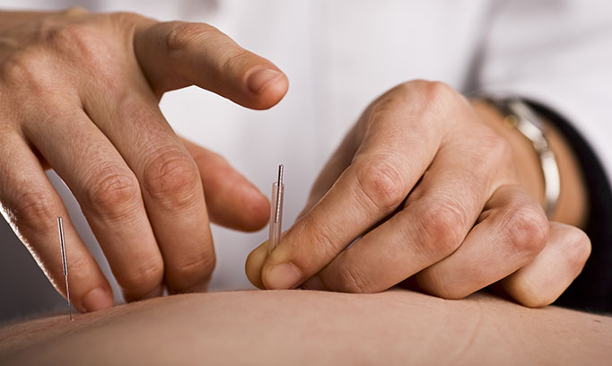 acupuncture to help with pain