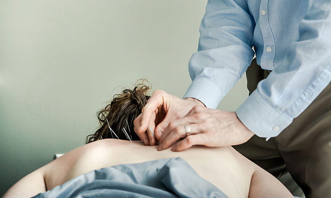 acupuncture stocksy medium 227413 682x408