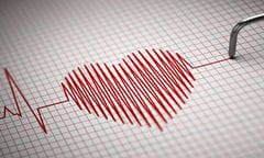 heart 463104065 682x408