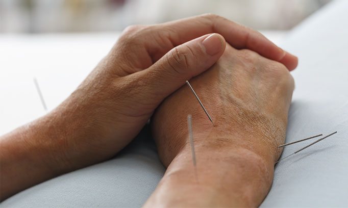 Acupuncture Acupuncture vs.