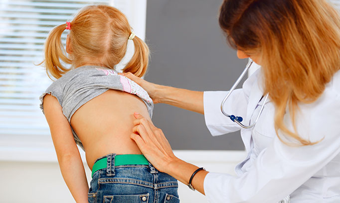 scoliosis in kids 642x408