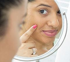 skin 170608657 214x192