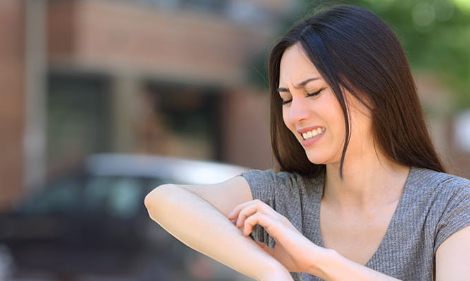 a woman outside scratching her irritated skin