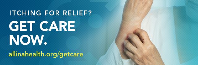 Itching for poison ivy relief? Get care now by going to allinahealth.org/getcare