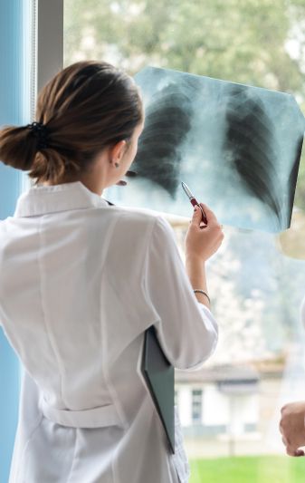 doctor looking at a lung Xray for lung cancer