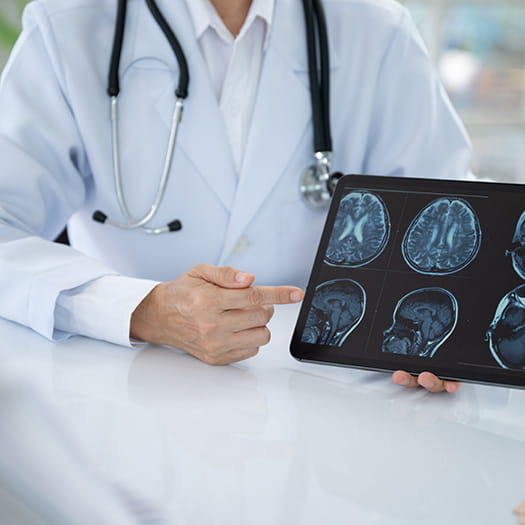 doctor with brain scans