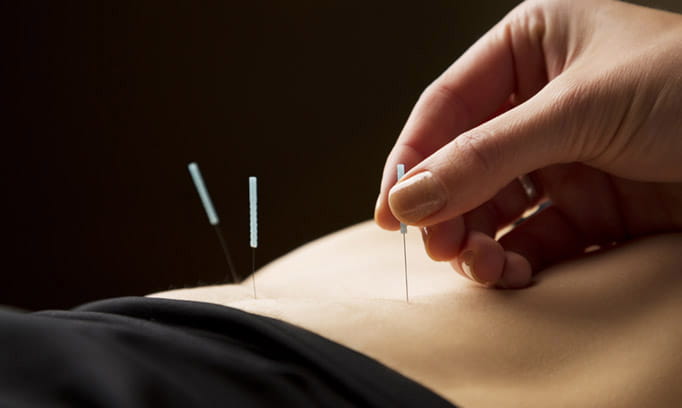acupuncture and infertility