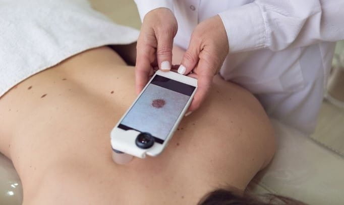 taking digital picture of mole on a person's back during skin check