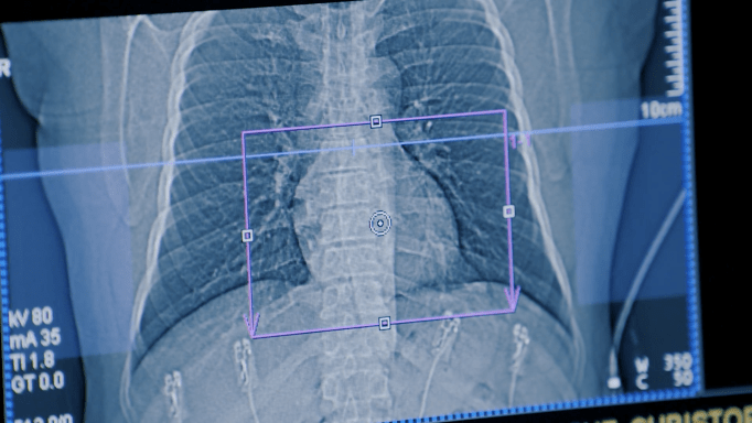 An image taken during a HeartScan test